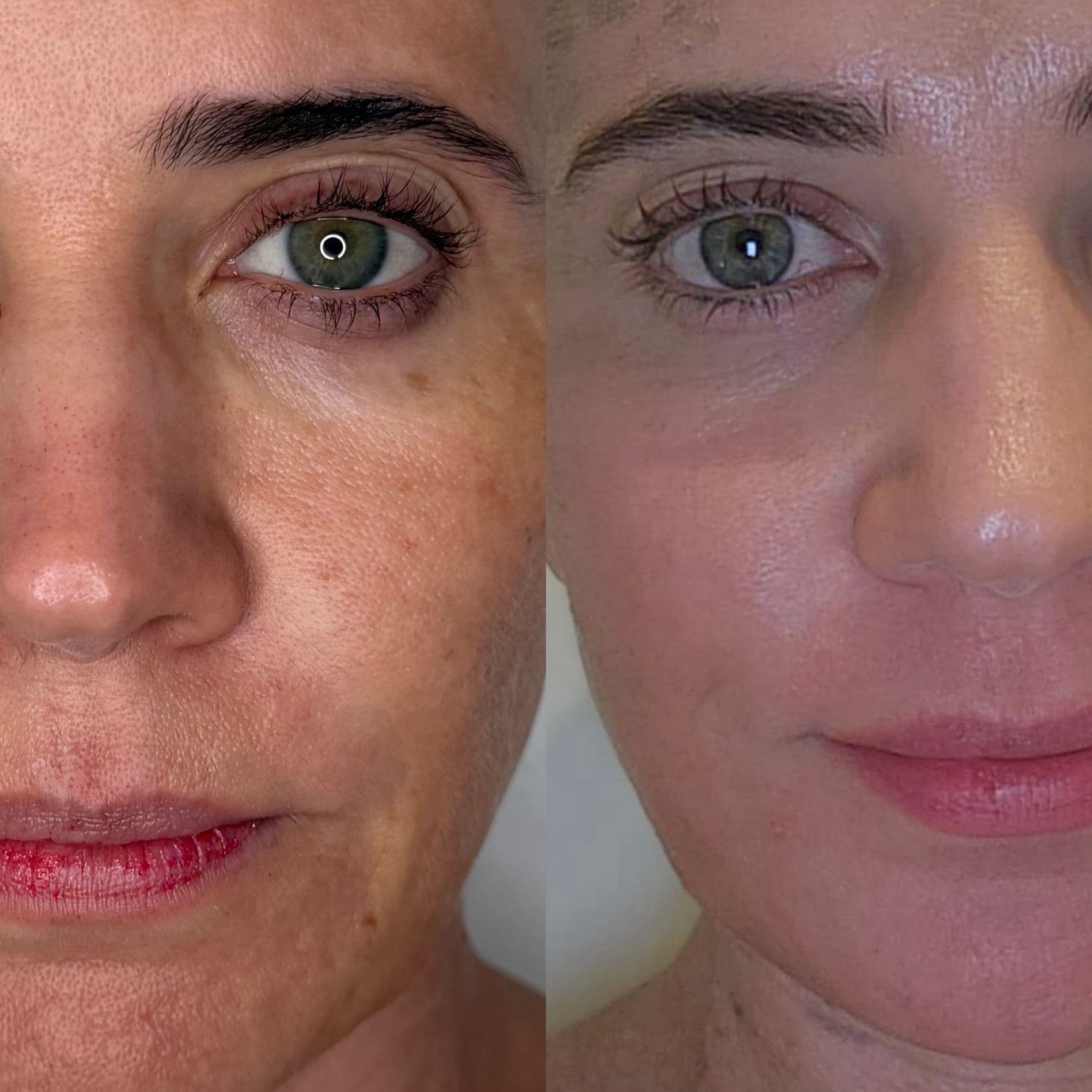 Before and after split-image comparison showing improved skin tone, clarity, and texture on the cheek and under-eye area