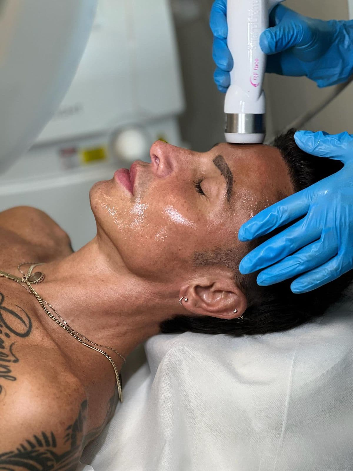 A provider administering a radiofrequency skin tightening treatment to a client's forehead in a treatment room at Infinity Beauty Lab